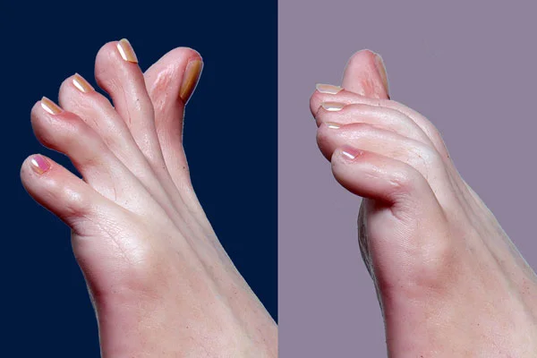 real lady pies articulados