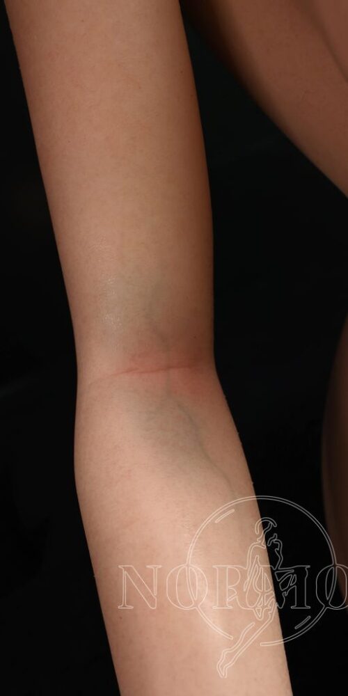 kora 165 kora silicone nature nm043 04